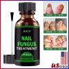 Toenail And Fingernail Fungus Treatment Extra Strength Antifungal Athletes Foot