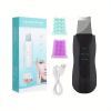 Ultrasonic Facial Cleansing Brush - Deep Cleansing and Blackhead Removal with Vibration Massage